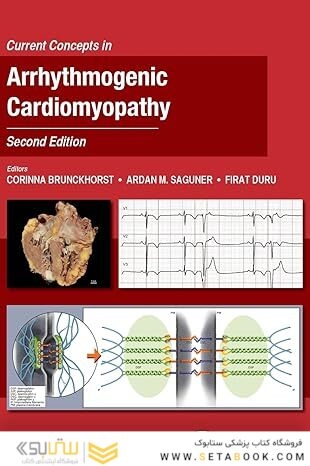 Current Concepts in Arrhythmogenic Cardiomyopathy, Second Edition