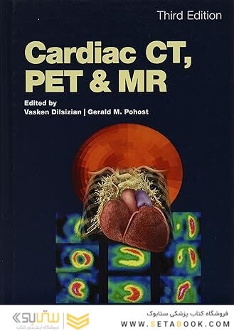 Cardiac CT, PET and MR