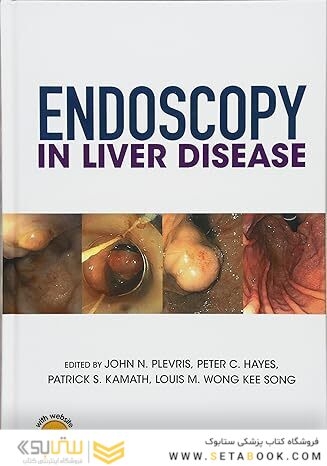 Endoscopy in Liver Disease 1st Edition