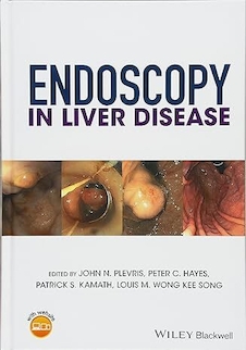 عکس Endoscopy in Liver Disease 1st Edition
