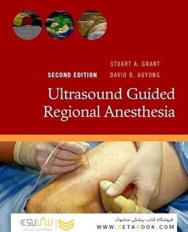Ultrasound Guided Regional Anesthesia 2nd Edition