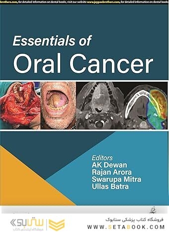 Essentials of Oral Cancer