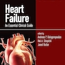 Heart Failure: An Essential Clinical Guide 1st Edition