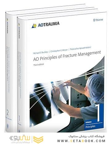 AO Principles of Fracture Management: Vol. 1: Principles, Vol. 2: Specific fractures 3rd Edition