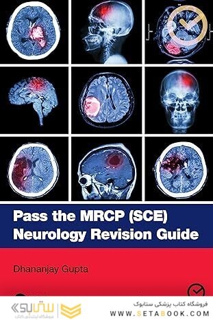 Pass the MRCP (SCE) Neurology Revision Guide  1st Edition