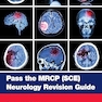 Pass the MRCP (SCE) Neurology Revision Guide  1st Edition