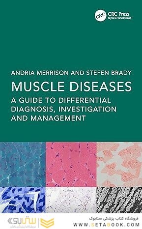 Muscle Diseases: A Guide to Differential Diagnosis, Investigation and Management 1st Edition