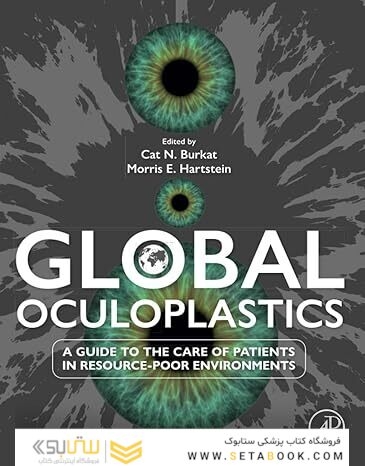 Global Oculoplastics: A Guide to the Care of Patients in Resource-Poor Environments 1st Edition