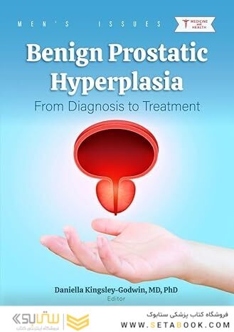 Benign Prostatic Hyperplasia: From Diagnosis to Treatment