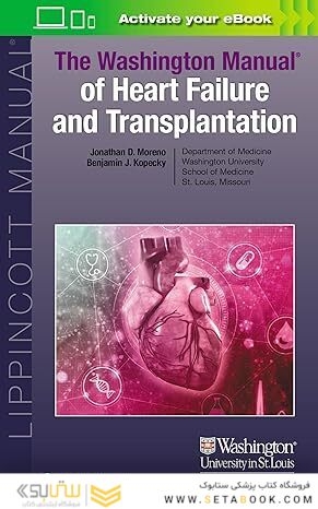 The Washington Manual of Heart Failure and Transplantation First Edition