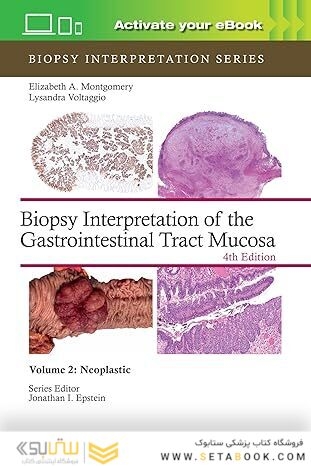 Biopsy Interpretation of the Gastrointestinal Tract Mucosa Volume 2
