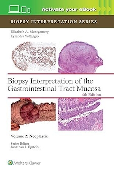 عکس Biopsy Interpretation of the Gastrointestinal Tract Mucosa Volume 2