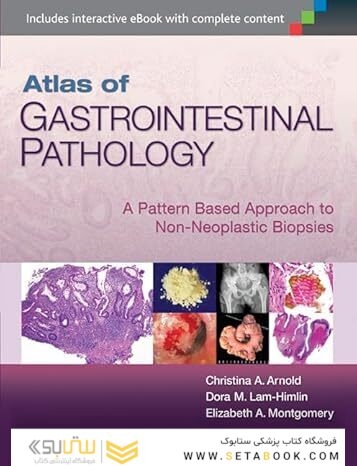 Atlas of Gastrointestinal Pathology: A Pattern Based Approach to Non-Neoplastic Biopsies First Edition