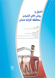 عکس اصول و روش های کشیدن محافظه کارانه دندان