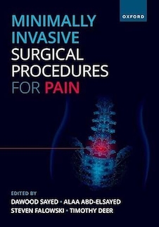 عکس Minimally Invasive Surgical Procedures for Pain