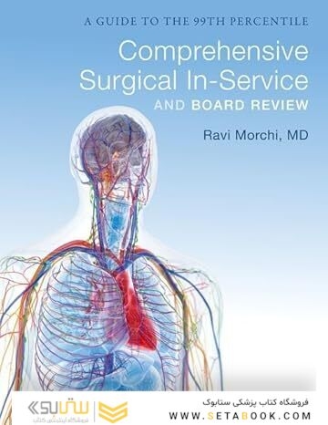 General Surgery Board Review: A Guide to the 99th Percentile