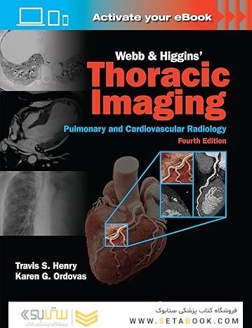 Webb & Higgins Thoracic Imaging