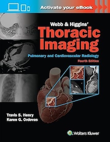 عکس Webb - Higgins Thoracic Imaging