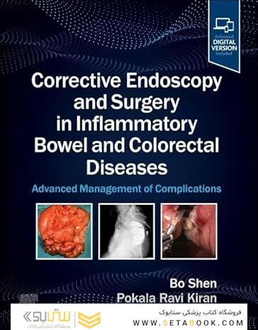 Corrective Endoscopy and Surgery in Inflammatory Bowel and Colorectal Diseases: Advanced Management of Complications