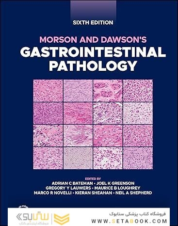 Morson and Dawson