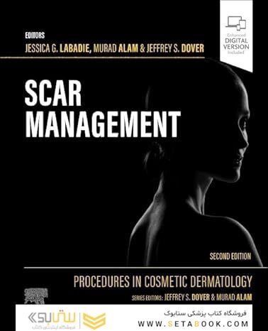 Procedures in Cosmetic Dermatology: Scar Management 2nd Edition
