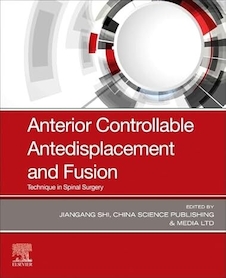 عکس Anterior Controllable Antedisplacement and Fusion: Technique in Spinal Surgery 1st Edition
