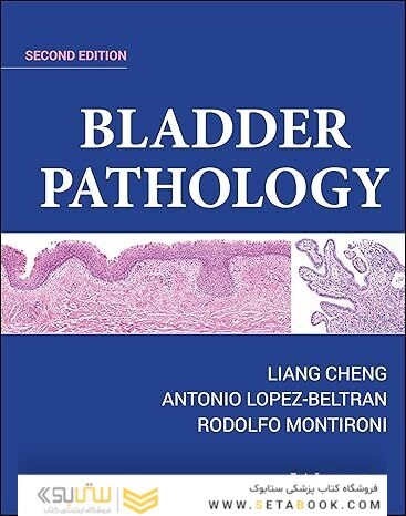 Bladder Pathology 2nd Edition