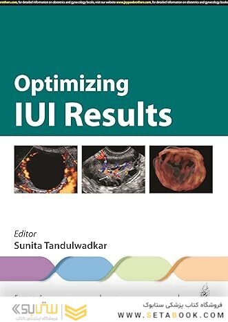 Optimizing IUI Results