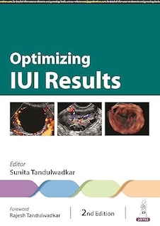عکس Optimizing IUI Results