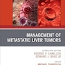 Management of Metastatic Liver Tumors, An Issue of Hematology/Oncology Clinics of North America