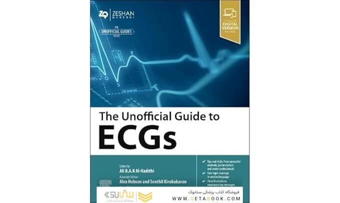 The Unofficial Guide to ECGs 1st Edition
