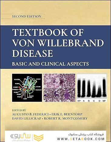 Textbook of Von Willebrand Disease: Basic and Clinical Aspects 2nd Edition