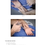 Manual of Splinting and Casting 2nd Edition