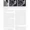Advanced Zygomatic Implants: The Zaga Concept 1st Edition