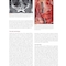 Advanced Zygomatic Implants: The Zaga Concept 1st Edition