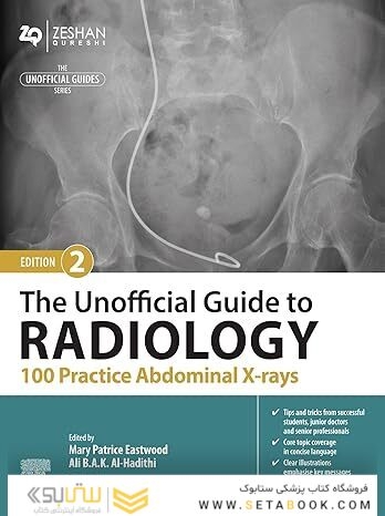 The Unofficial Guide to Radiology: 100 Practice Abdominal X-rays 2nd Edition