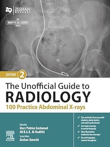 عکس The Unofficial Guide to Radiology: 100 Practice Abdominal X-rays 2nd Edition