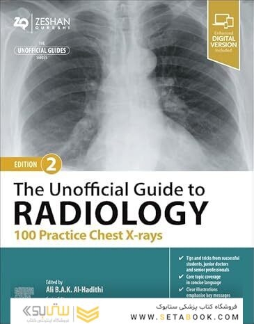The Unofficial Guide to Radiology: 100 Practice Chest X-rays 2nd Edition