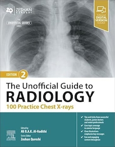 عکس The Unofficial Guide to Radiology: 100 Practice Chest X-rays 2nd Edition