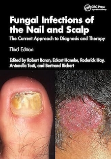 عکس Fungal Infections of the Nail and Scalp: The Current Approach to Diagnosis and Therapy 3rd Edition