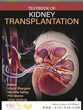 Textbook of Kidney Transplantation 1st Edition