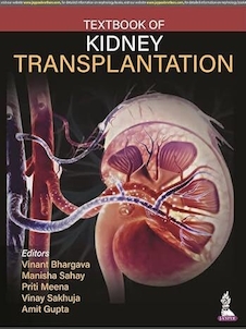 عکس Textbook of Kidney Transplantation 1st Edition