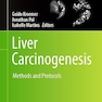 Liver Carcinogenesis: Methods and Protocols (Methods in Molecular Biology)