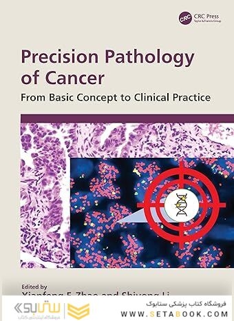Precision Pathology of Cancer: From Basic Concept to Clinical Practice 1st Edition