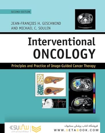 Interventional Oncology: Principles and Practice of Image-Guided Cancer Therapy 2nd Edition