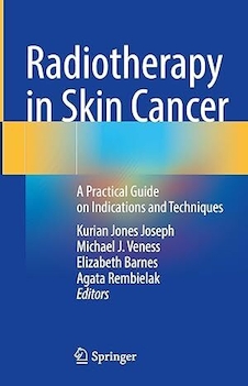 عکس Radiotherapy in Skin Cancer: A Practical Guide on Indications and Techniques 2023rd Edition