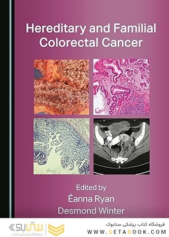 Hereditary and Familial Colorectal Cancer 1st Edition