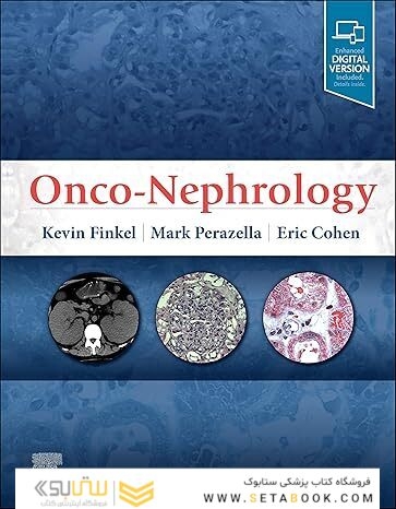 Onco-Nephrology 1st Edition