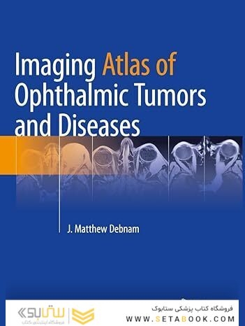 Imaging Atlas of Ophthalmic Tumors and Diseases 2023rd Edition