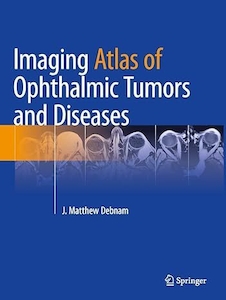 عکس Imaging Atlas of Ophthalmic Tumors and Diseases 2023rd Edition